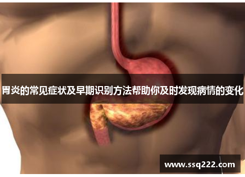 胃炎的常见症状及早期识别方法帮助你及时发现病情的变化